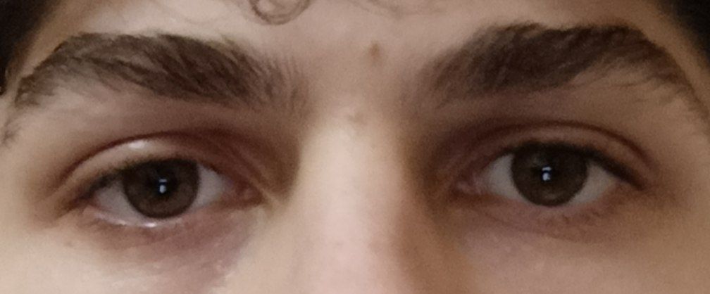 1000088251