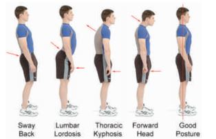 Posture