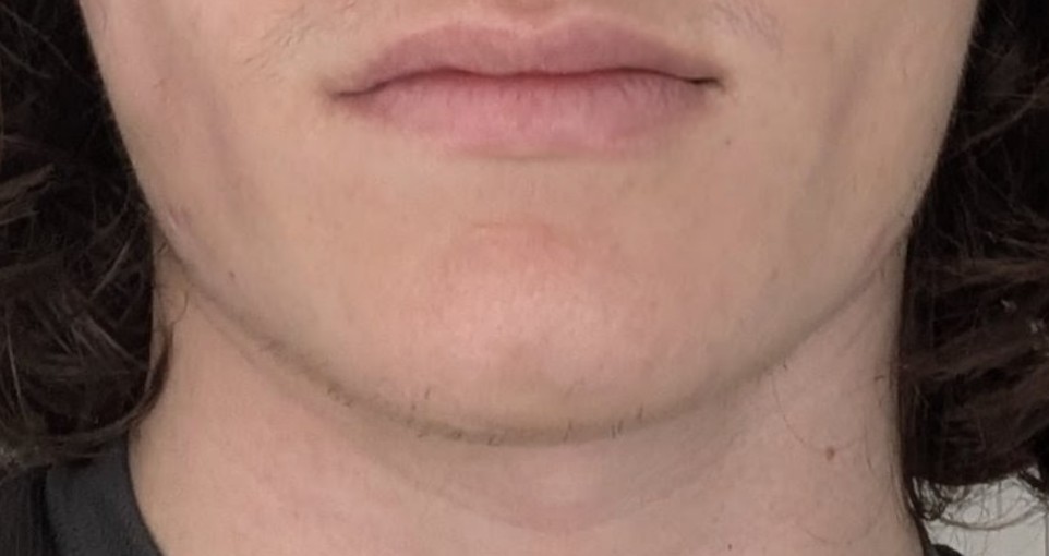 14961