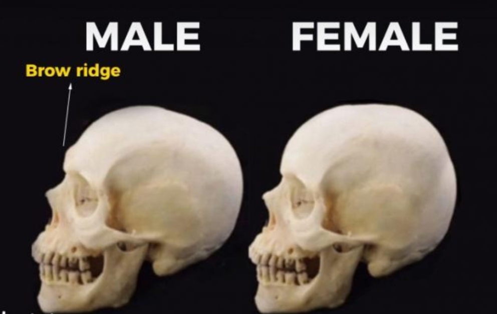 12452