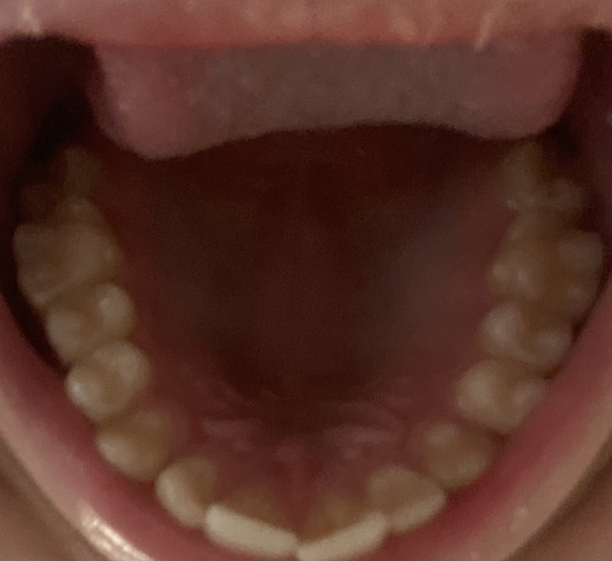 FullSizeRender
