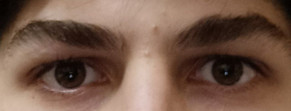 1000088360