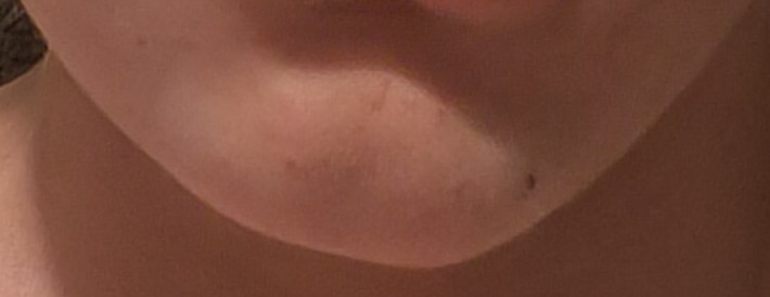 1000005164