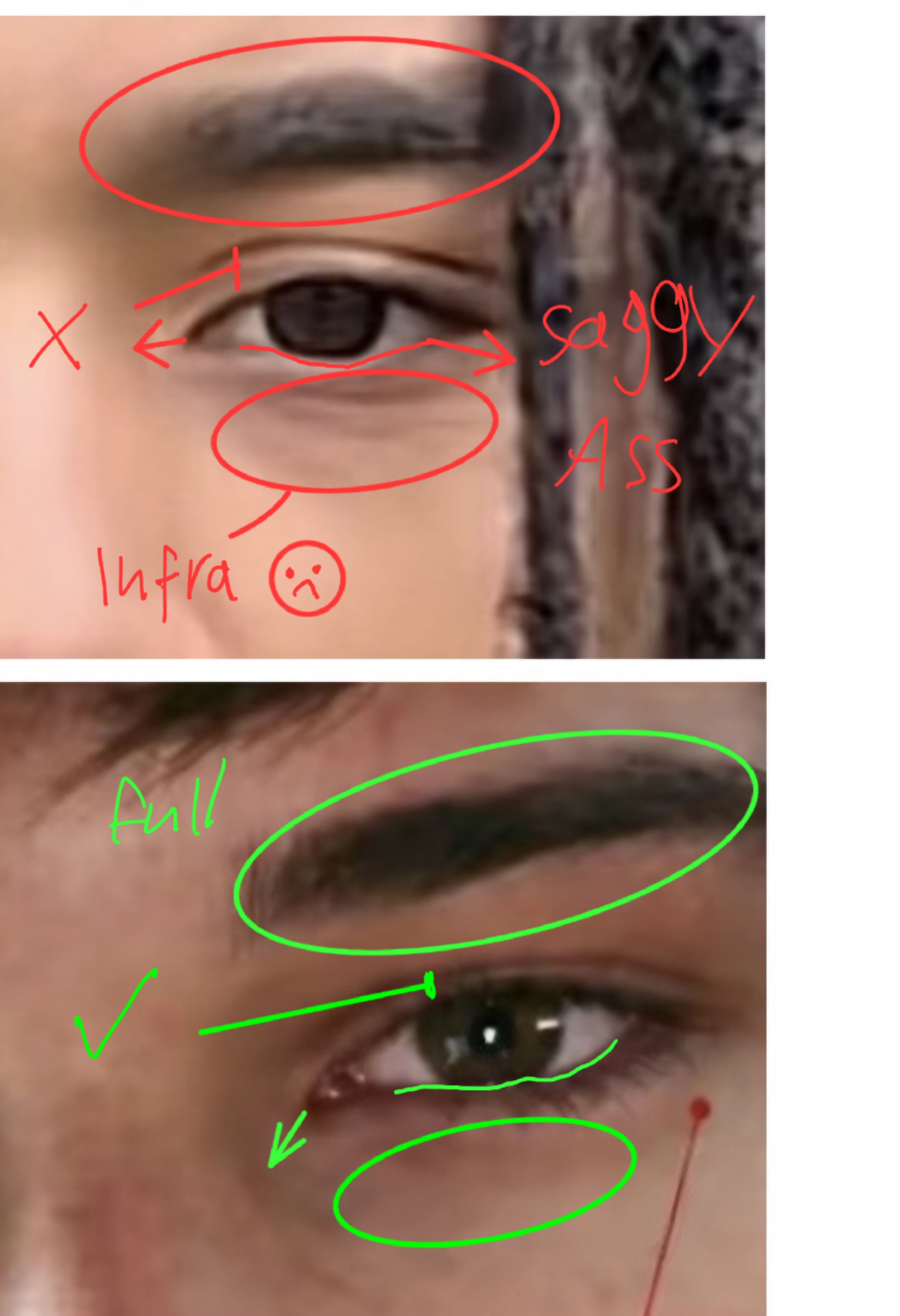 1000141802
