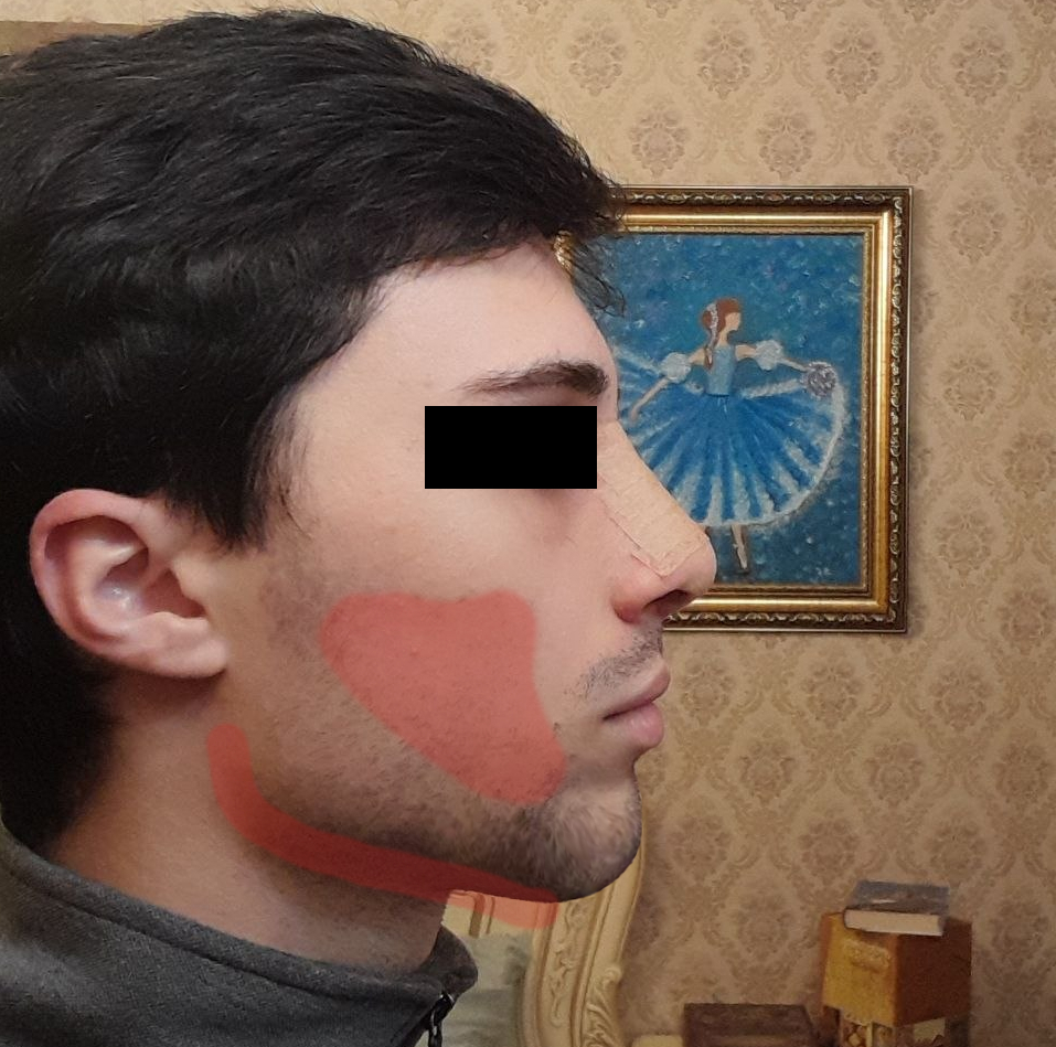 6234460 1777966606288 1 1