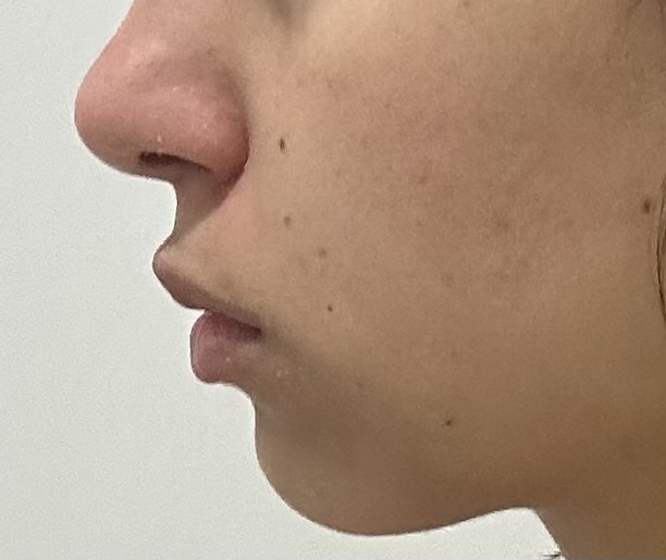 IMG 2456