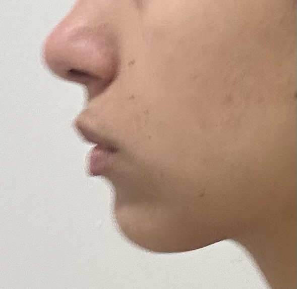 IMG 2459