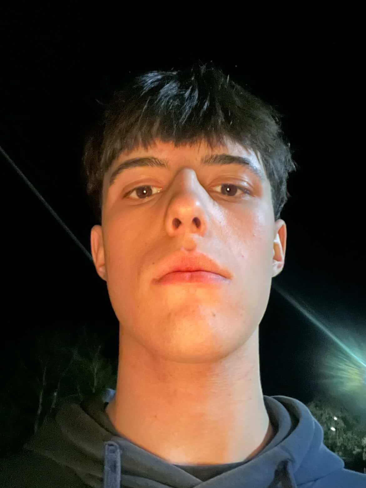 E