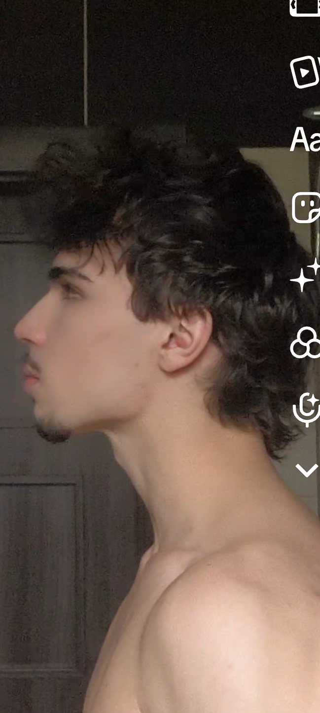 1000003404