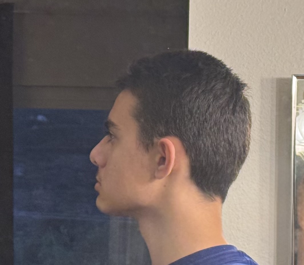 IMG 2813