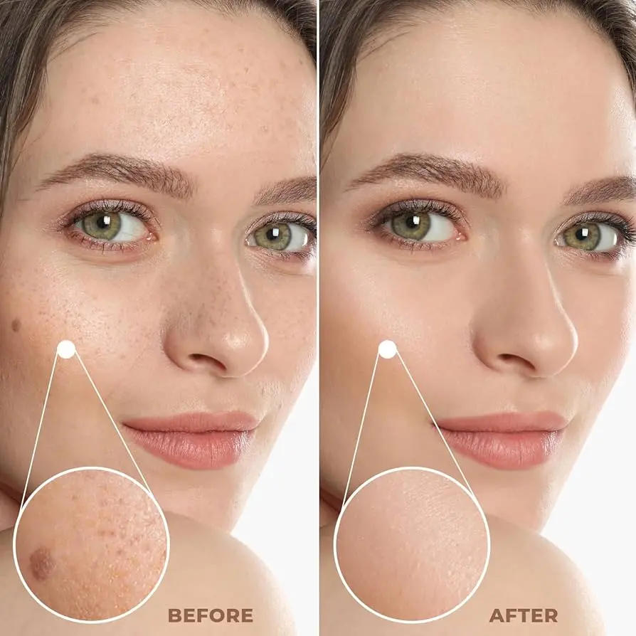 ghk cu before and after looksmax.org Ghk-cu guide - full guide including doses (ghkcu is not just for skin)  looksmaxxers and gym people gtfih | Looksmax.org