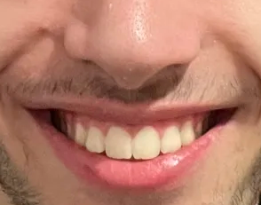 1778064655245