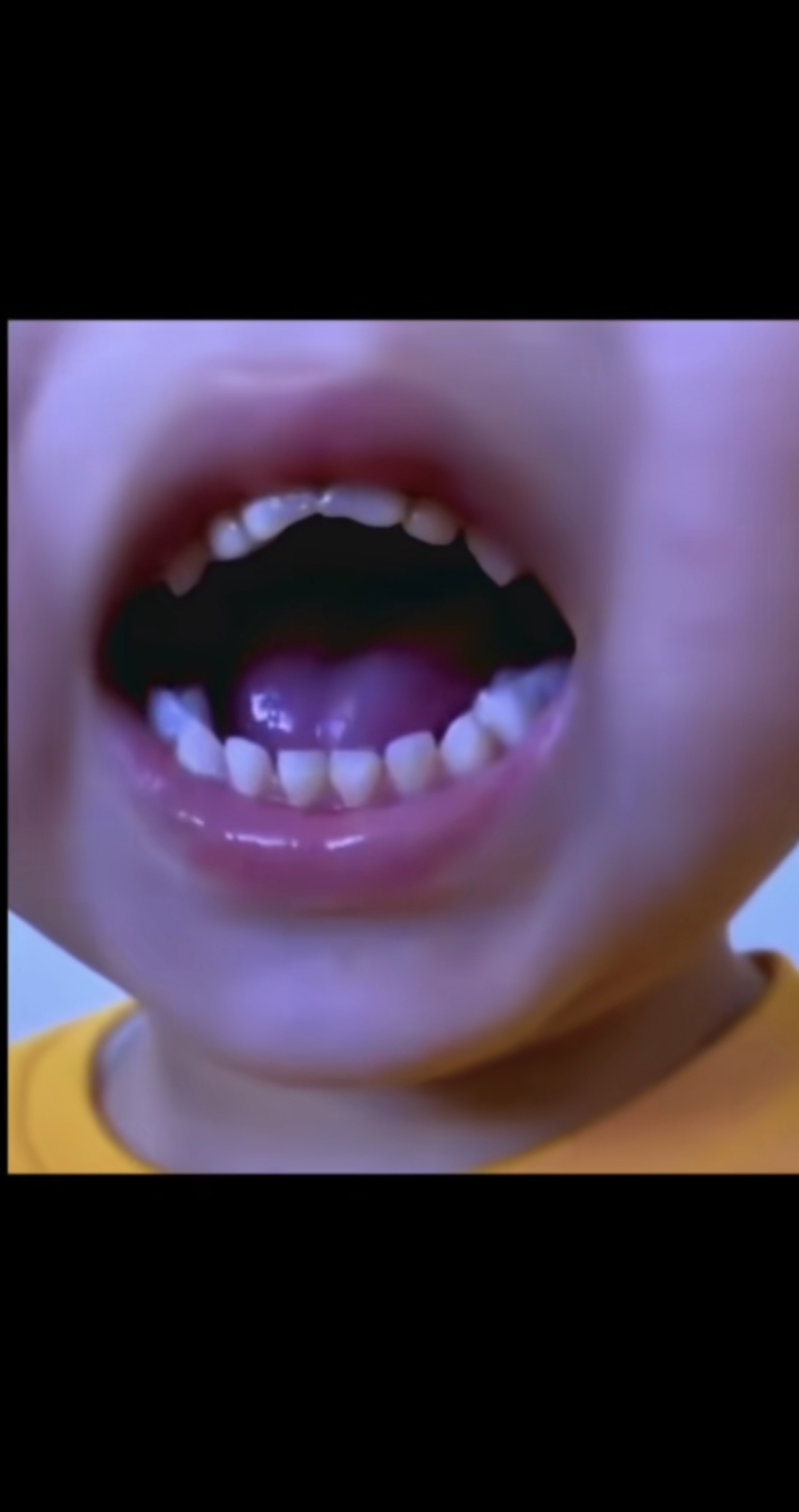 1000047410