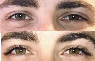 1000004164