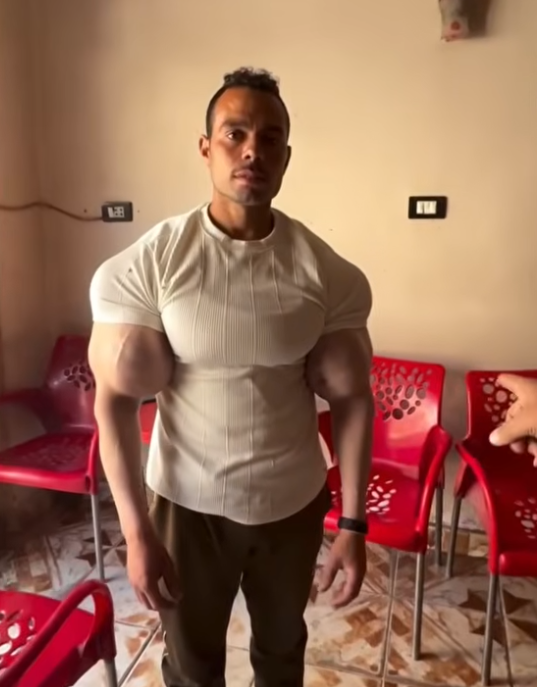 Ds