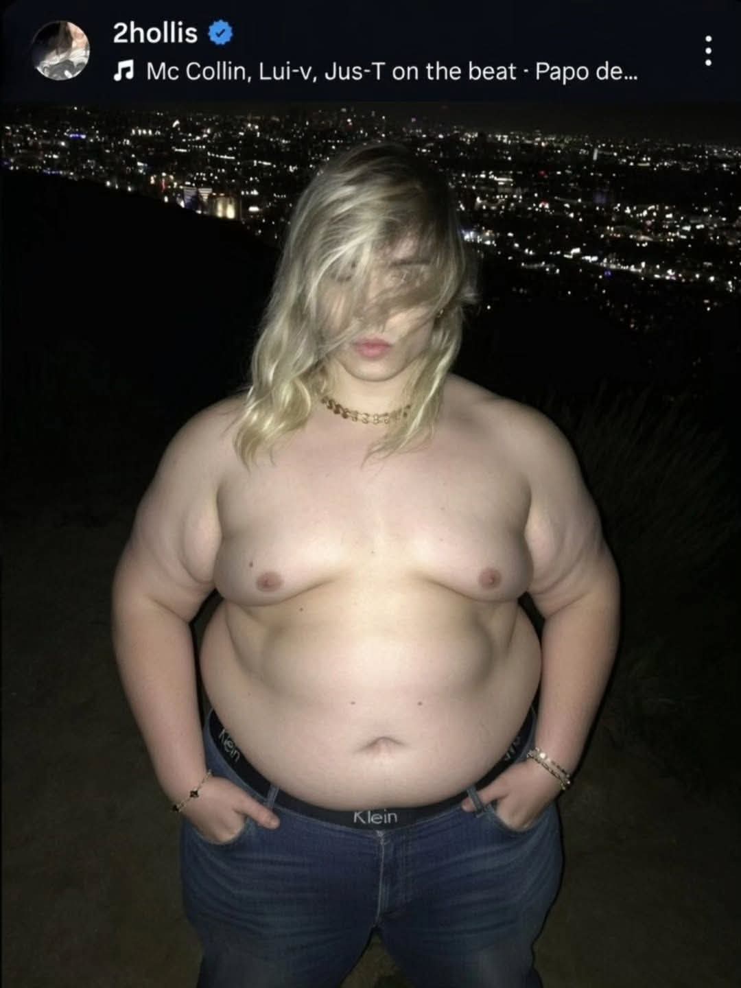 1000005521