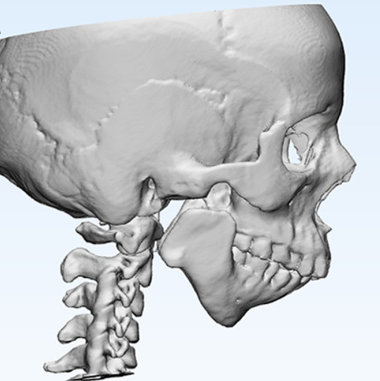 Skull