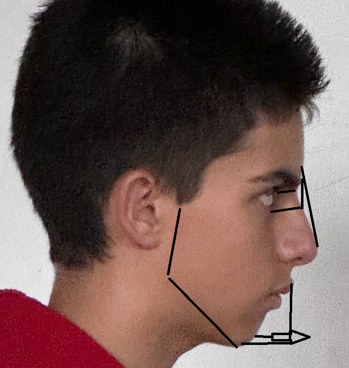 Sharp Front Retangle How to get forward growth | Looksmax.org - Men's Self-Improvement ...