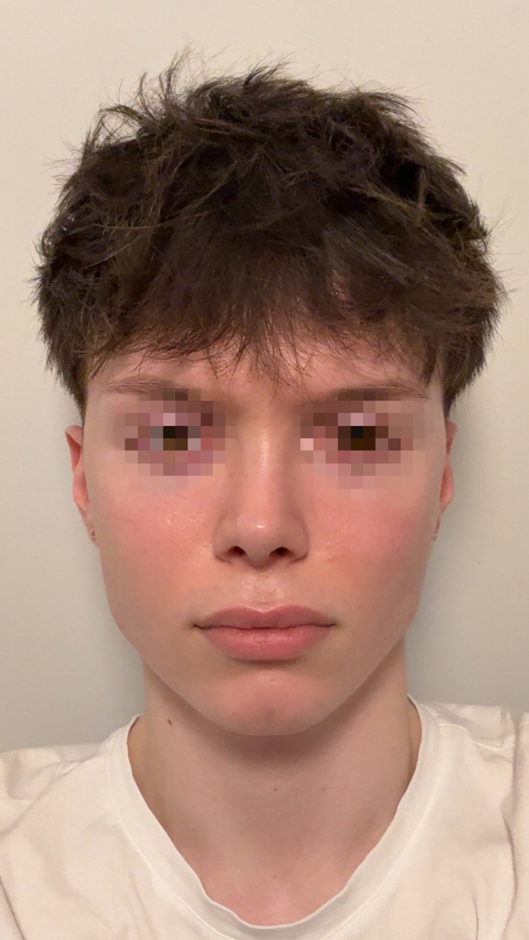 IMG 0771