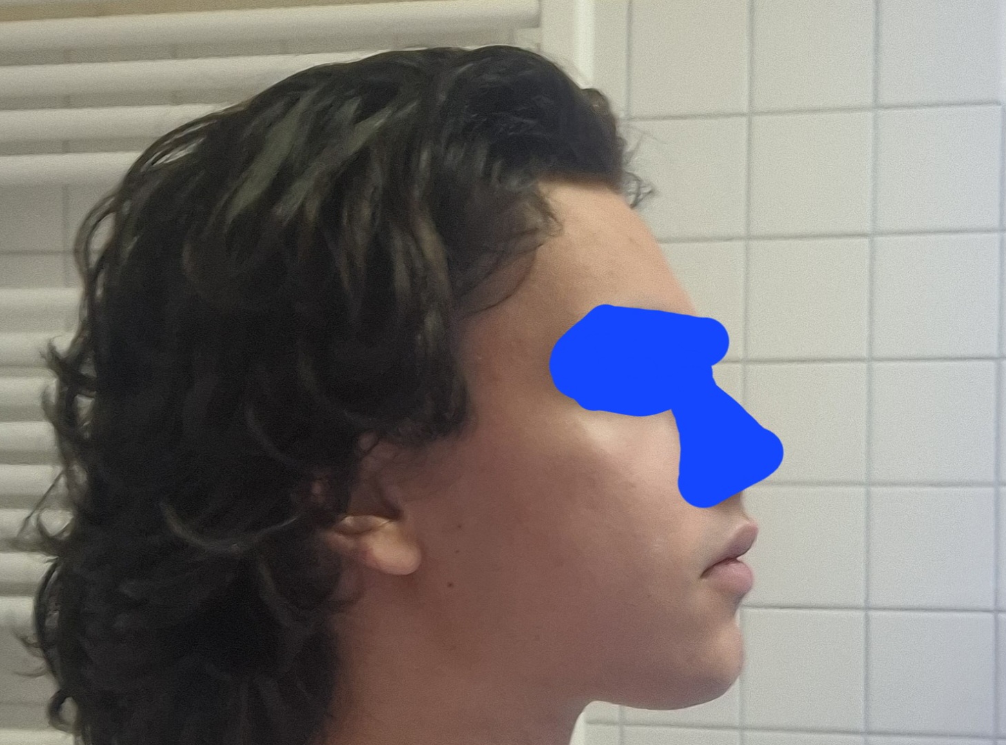 1000130566