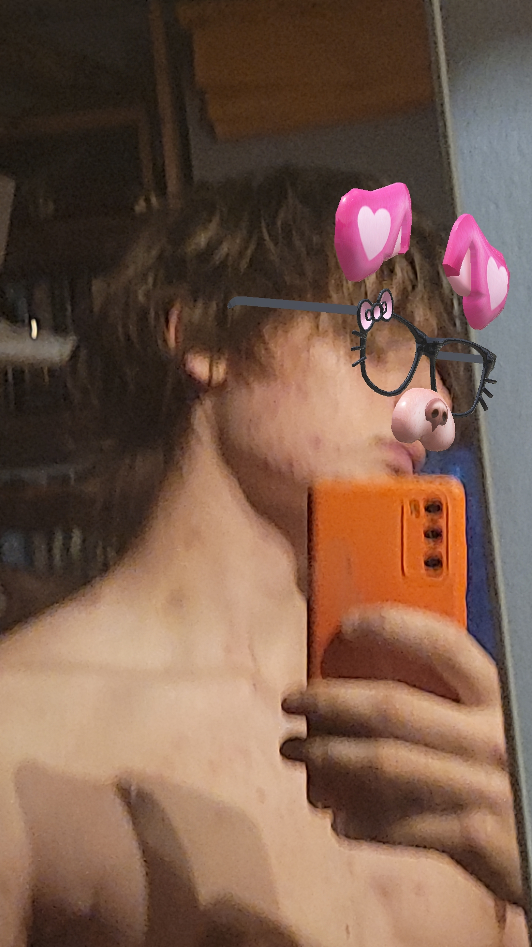 1000052571