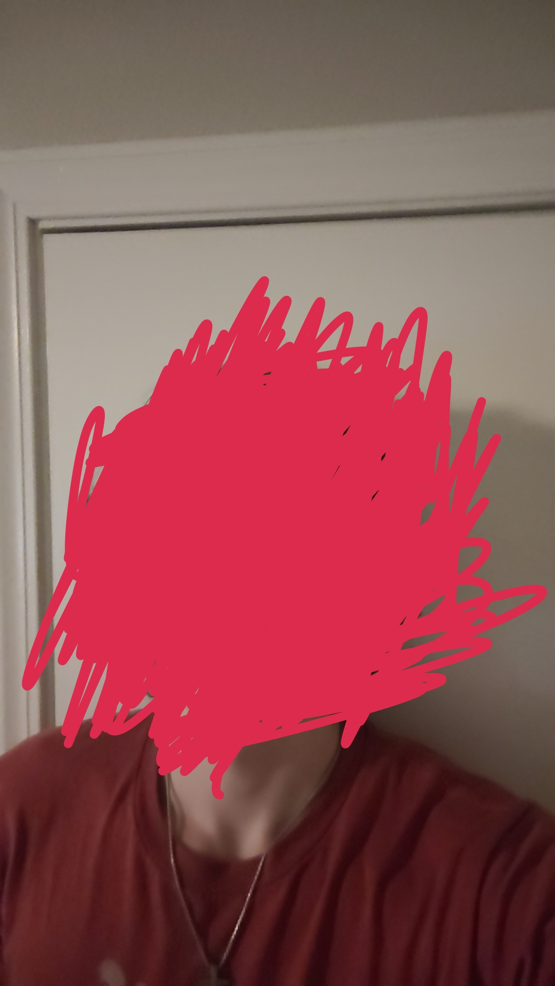 1000139387