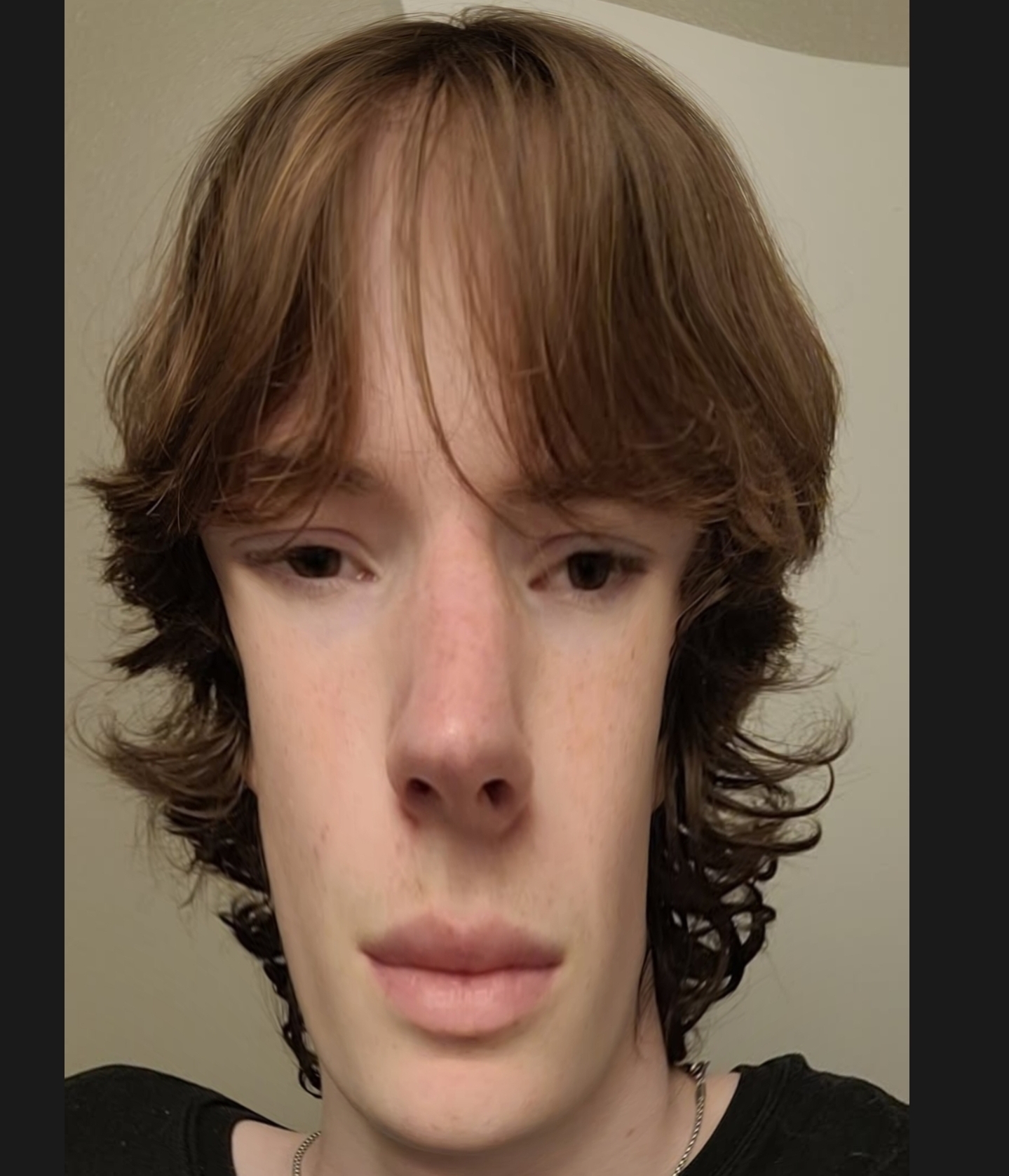 1000031581