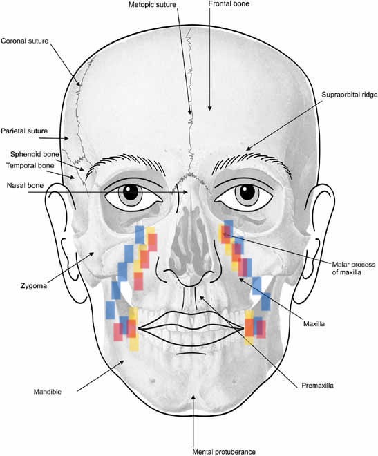 Face 1