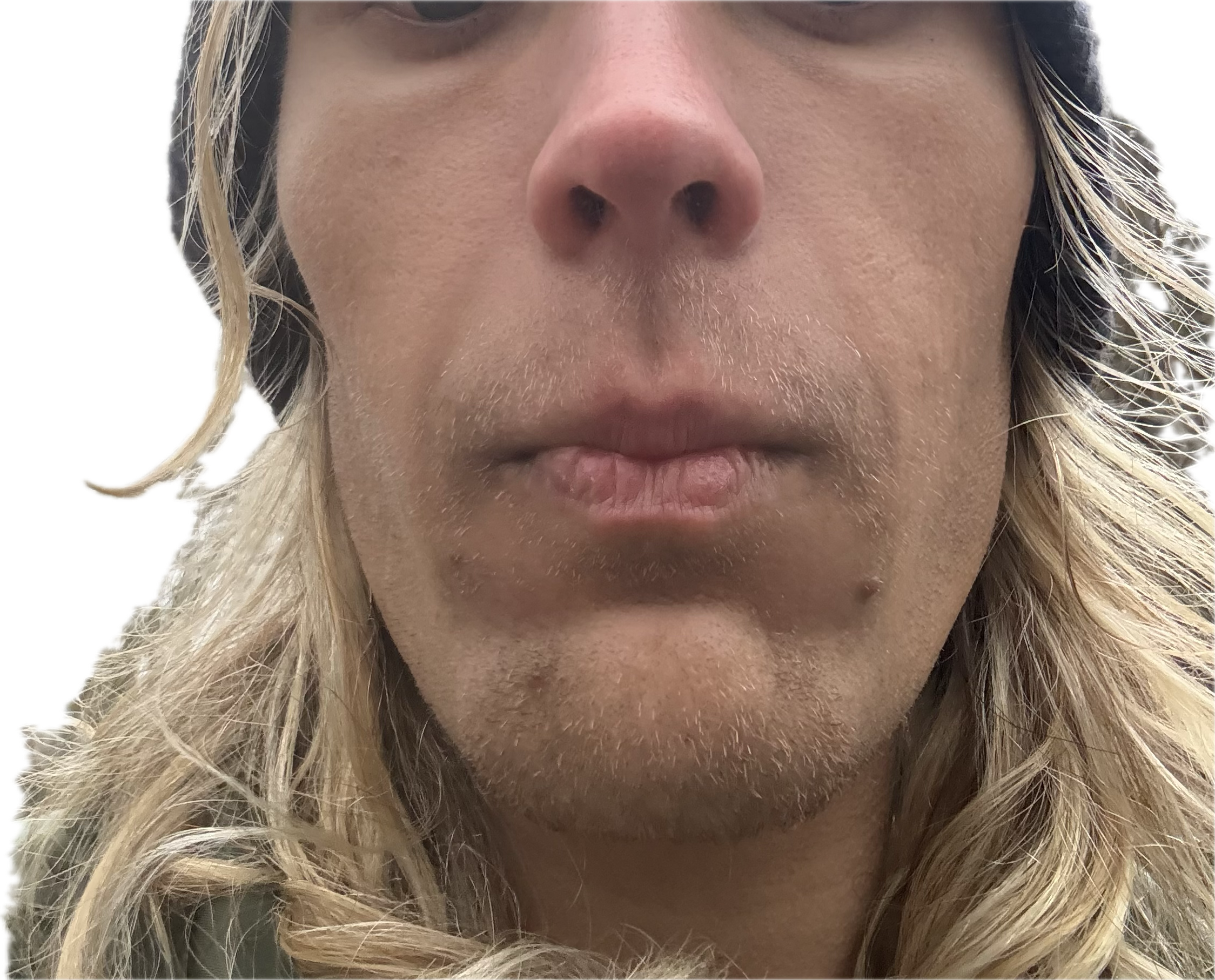 Image5