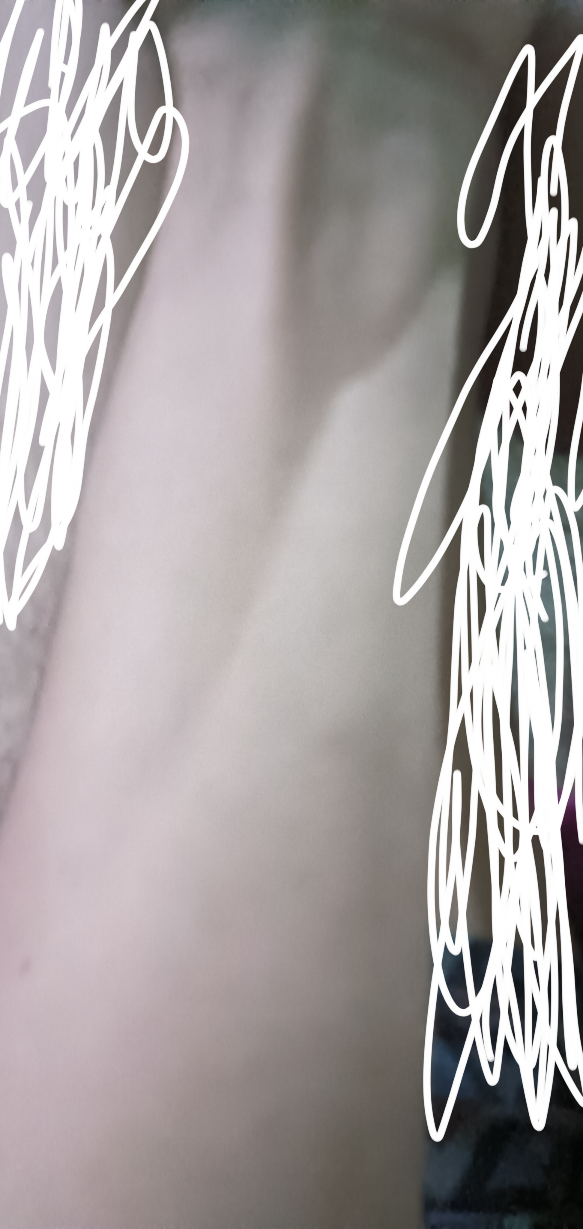 1000093708