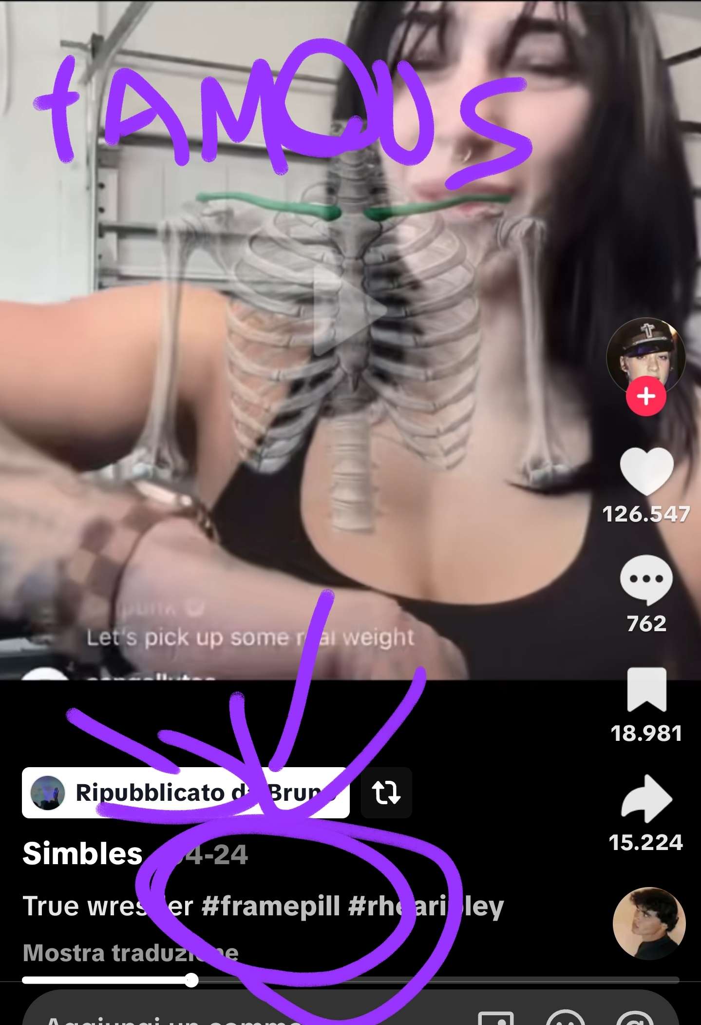 1000061656