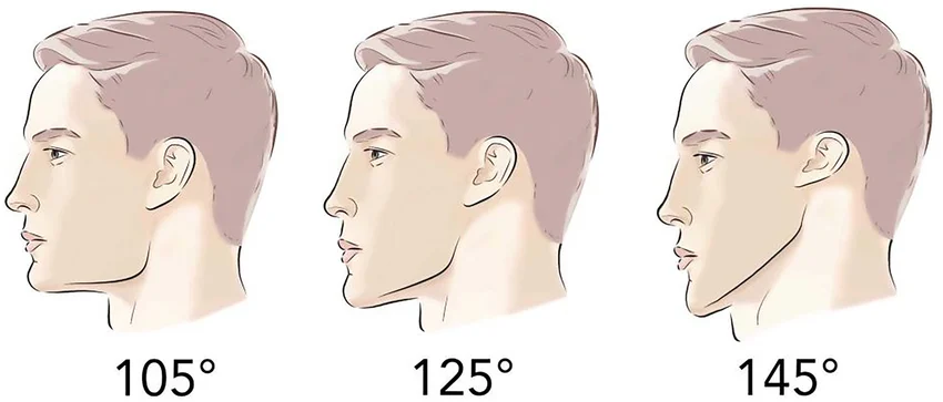 Gonial Angle 127 is typically considered a desirable gonial angle Men typically have