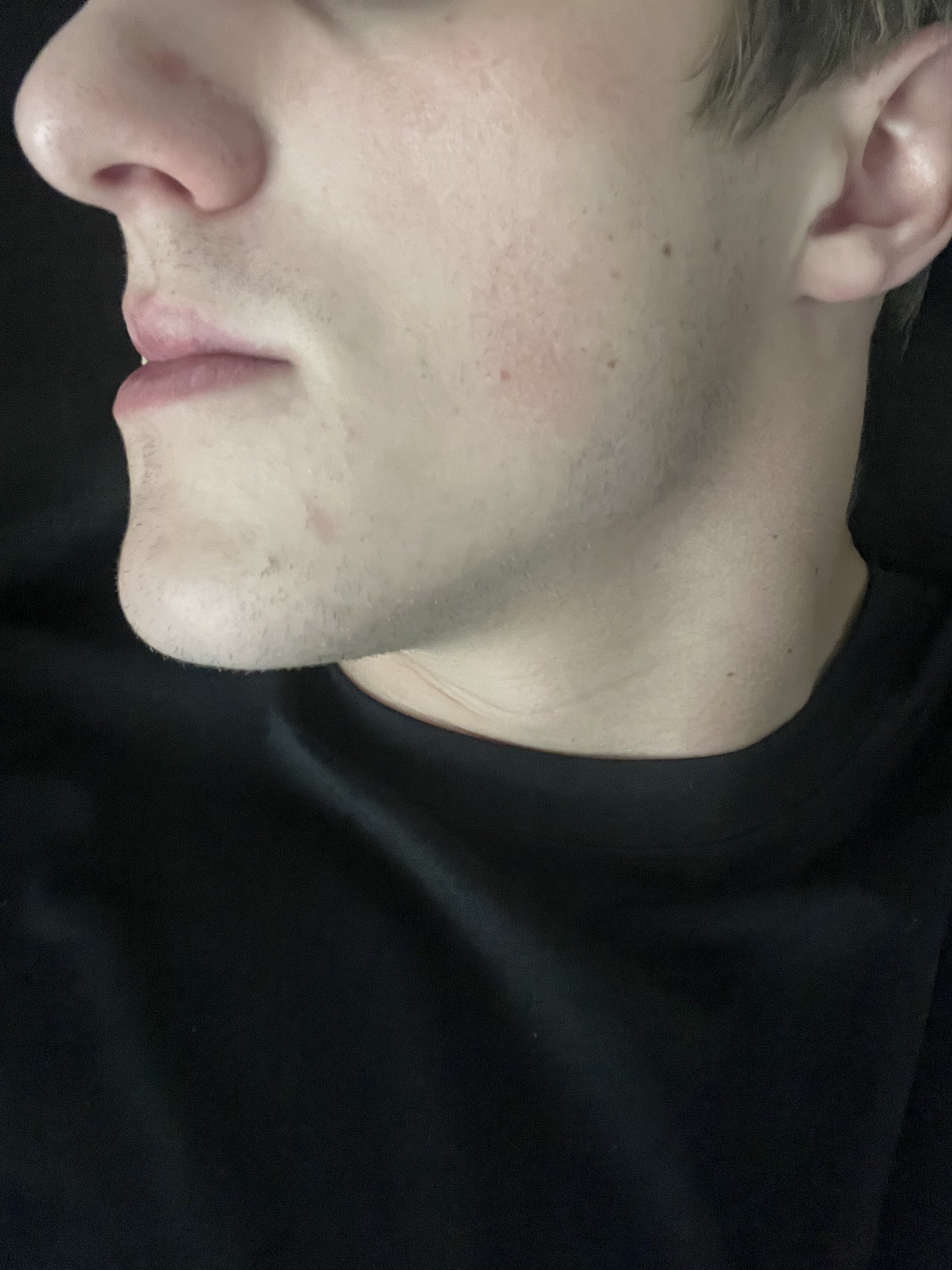 IMG 0763