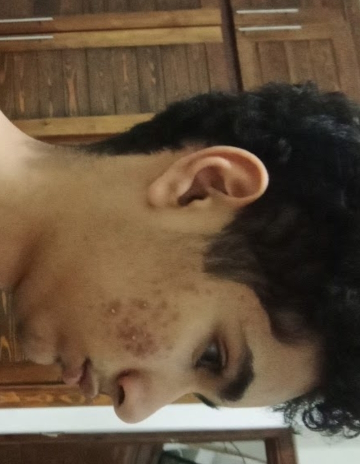 1000088308