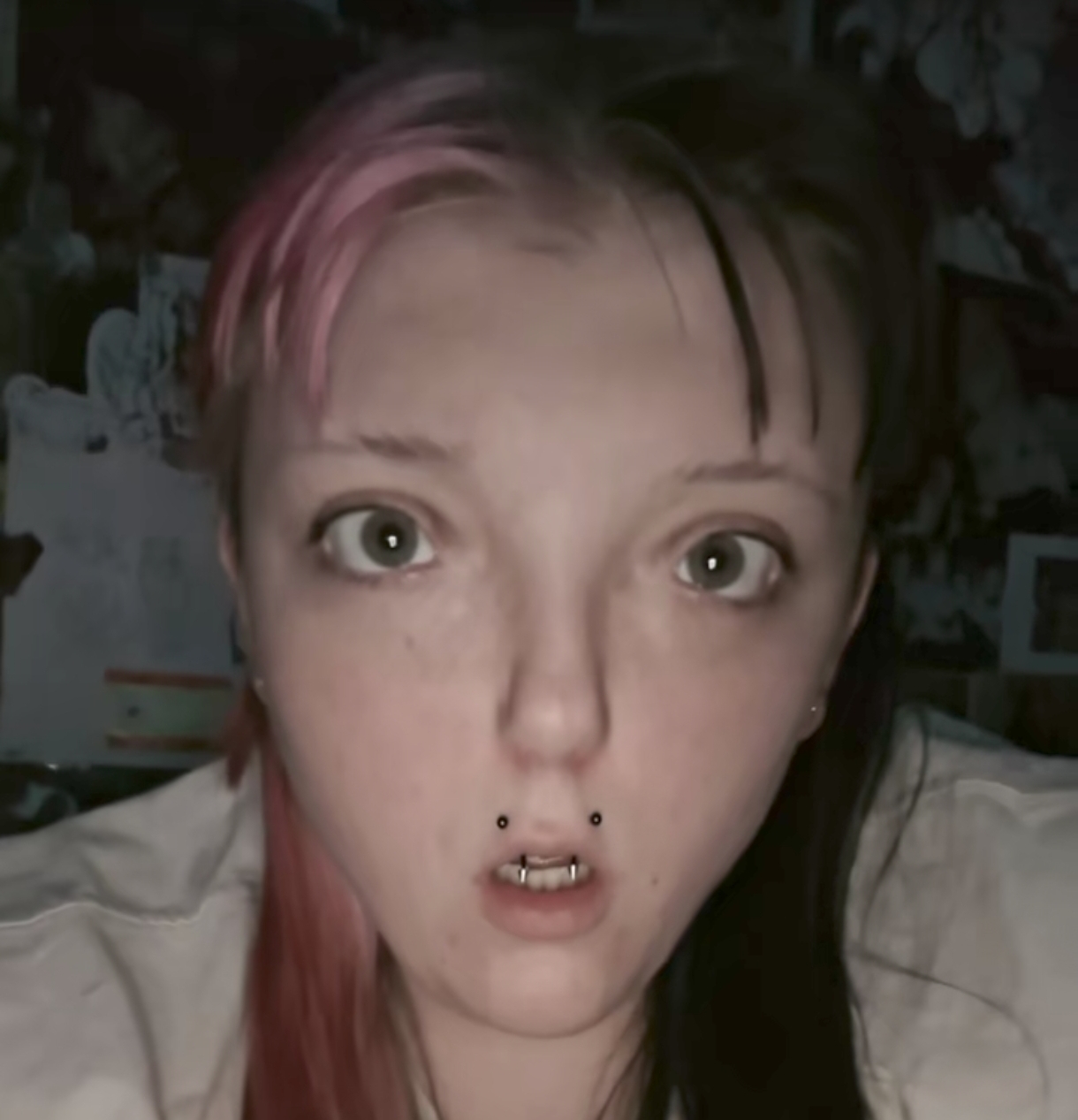 1000064313