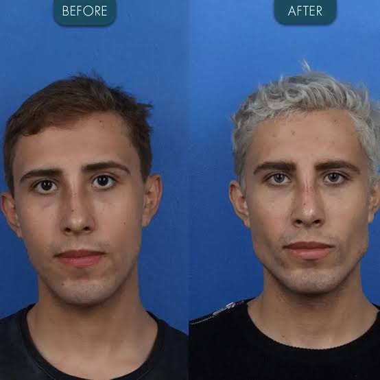 1000083858