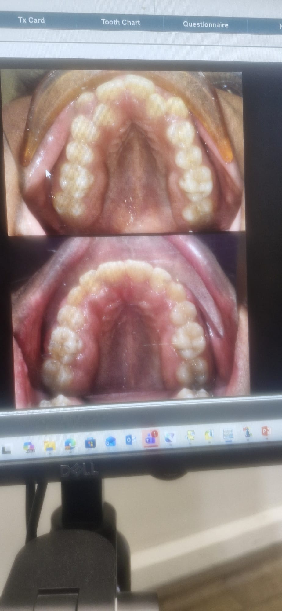 1000072565