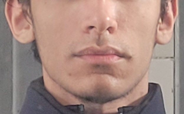 1000091187