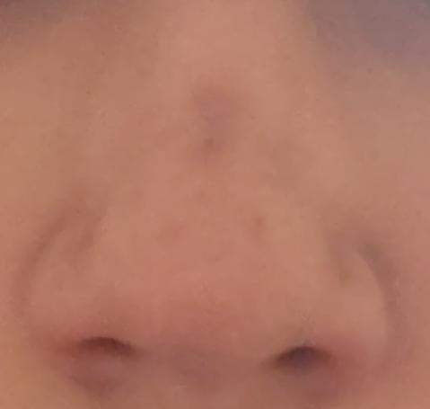 1000636503