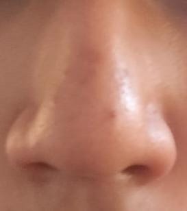 1000636502
