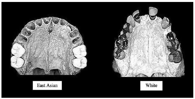 2275417 brain size iq and racial group differences evidence from musculoskeletal traits figure 5