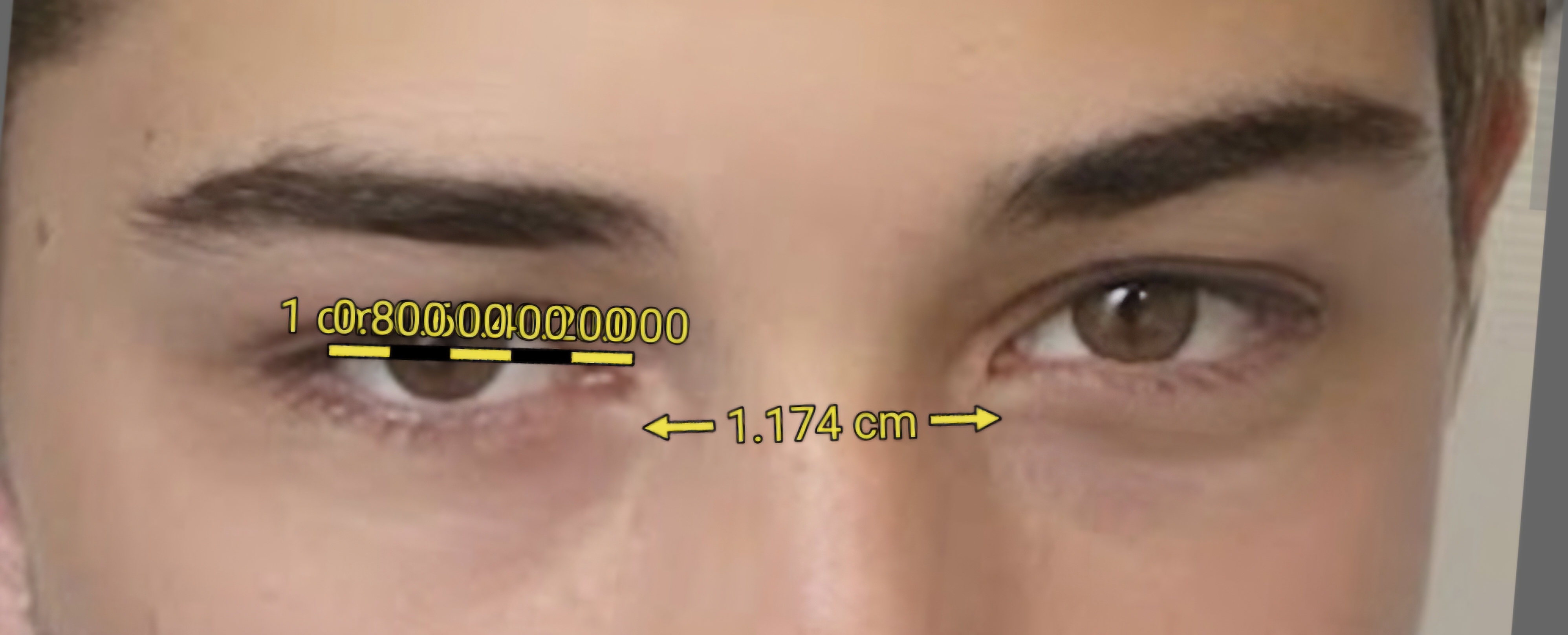 1000476326
