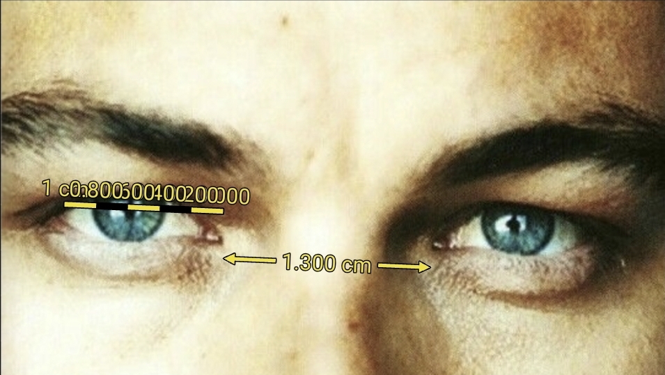 1000476318