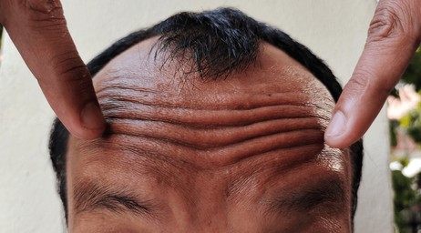 1000018025