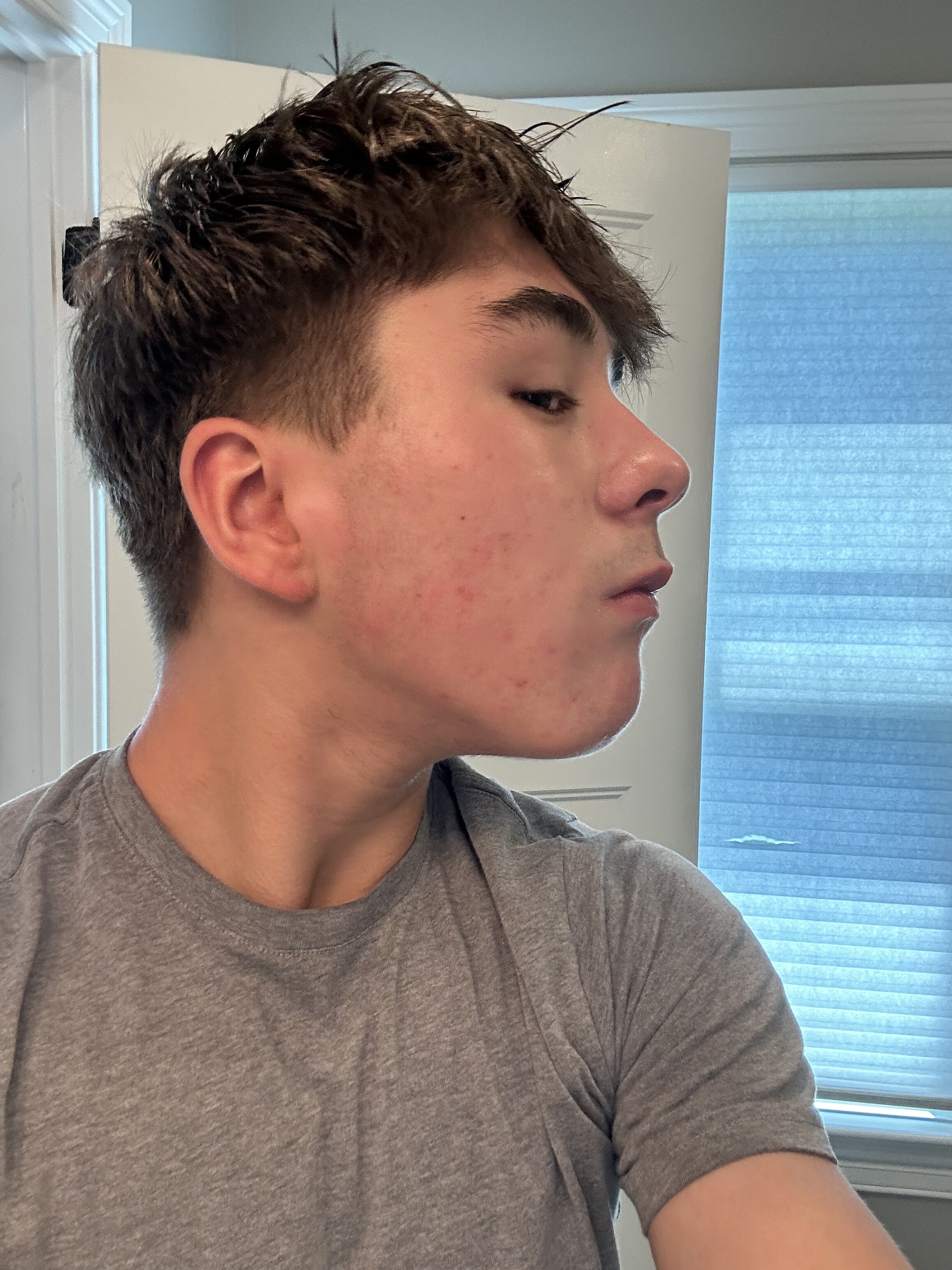 IMG 0583