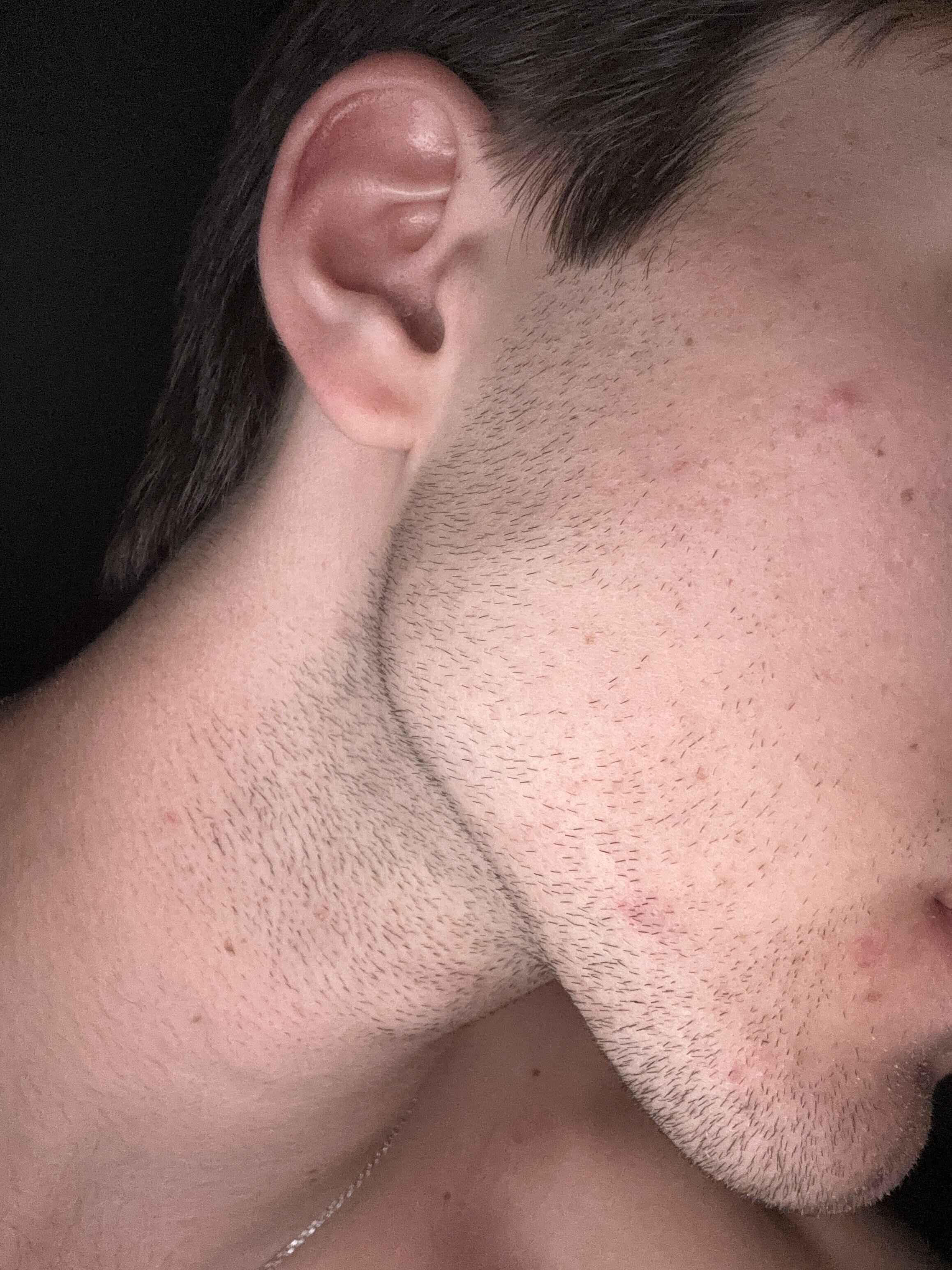 IMG 0484