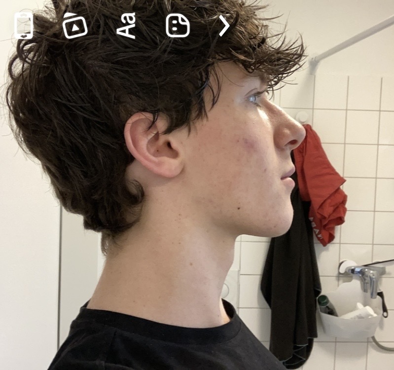IMG 7872