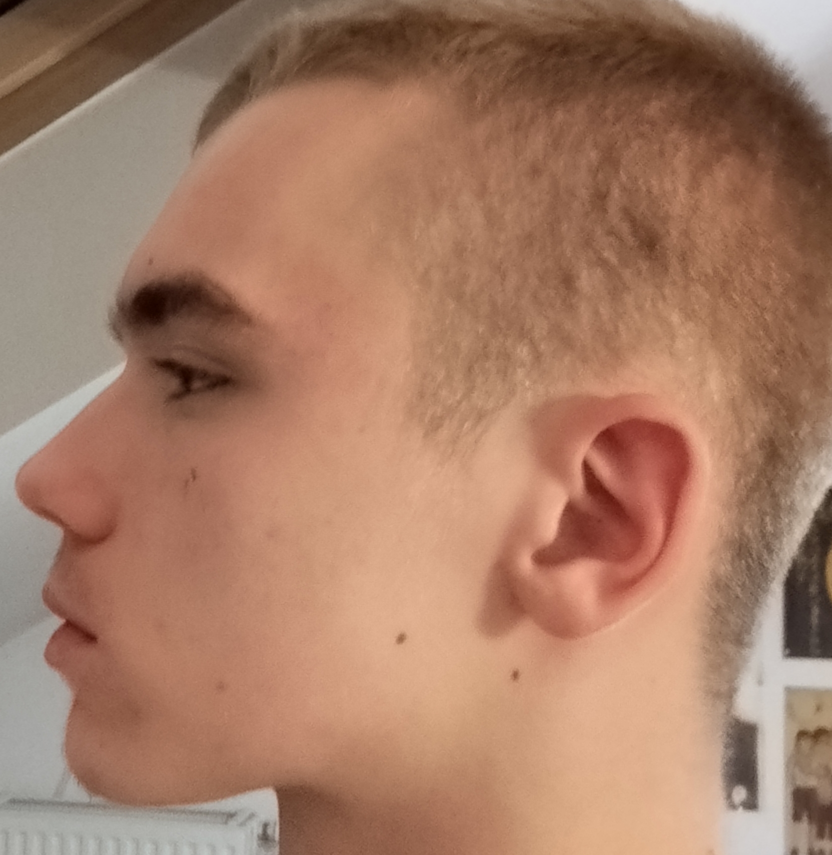 1000005664