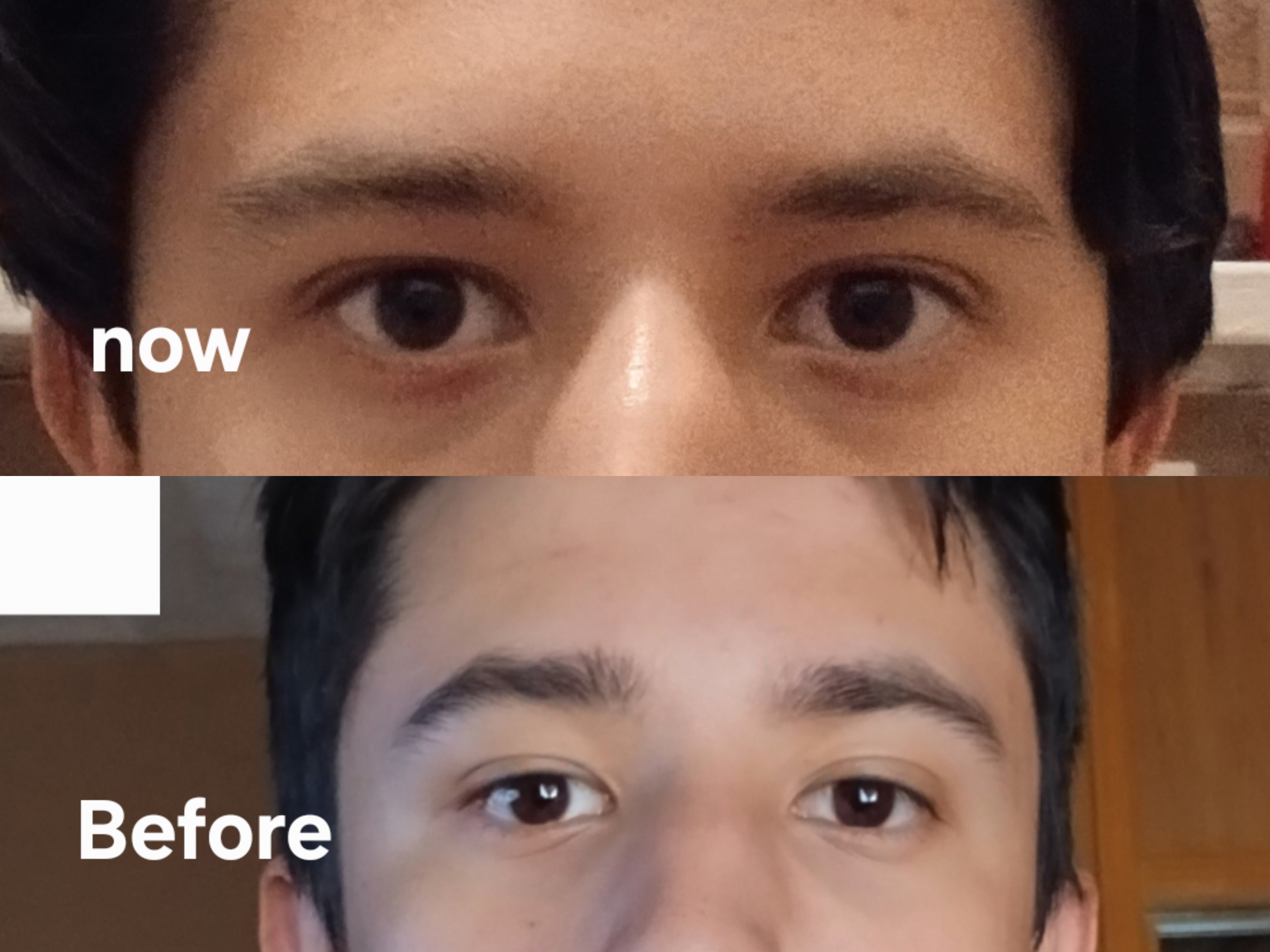 1000195688