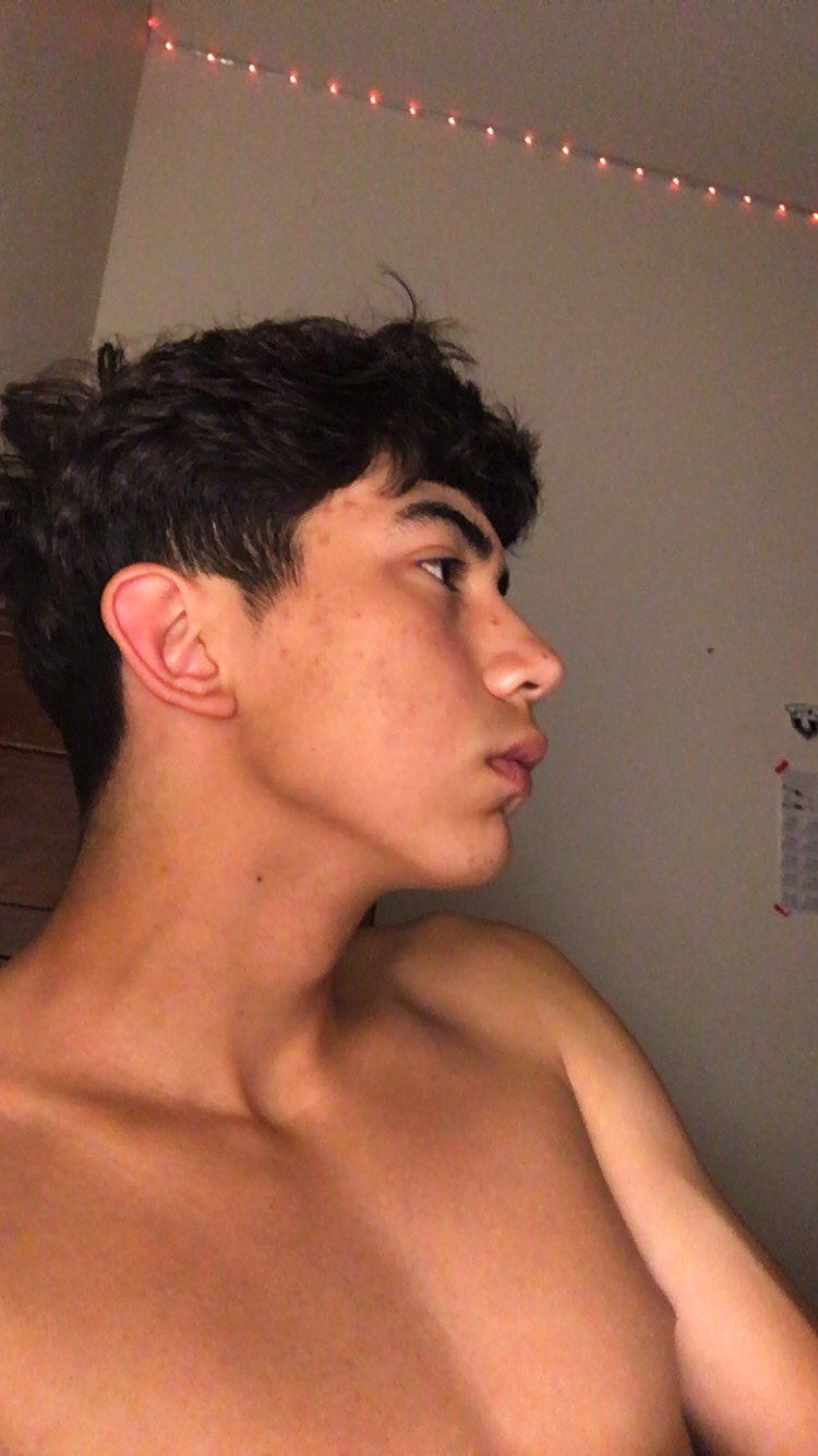 1000008718